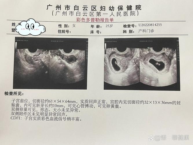 新港澳彩开奖号码记录和医生误做腹超被停工与医生误做腹超被停工怎么赔偿