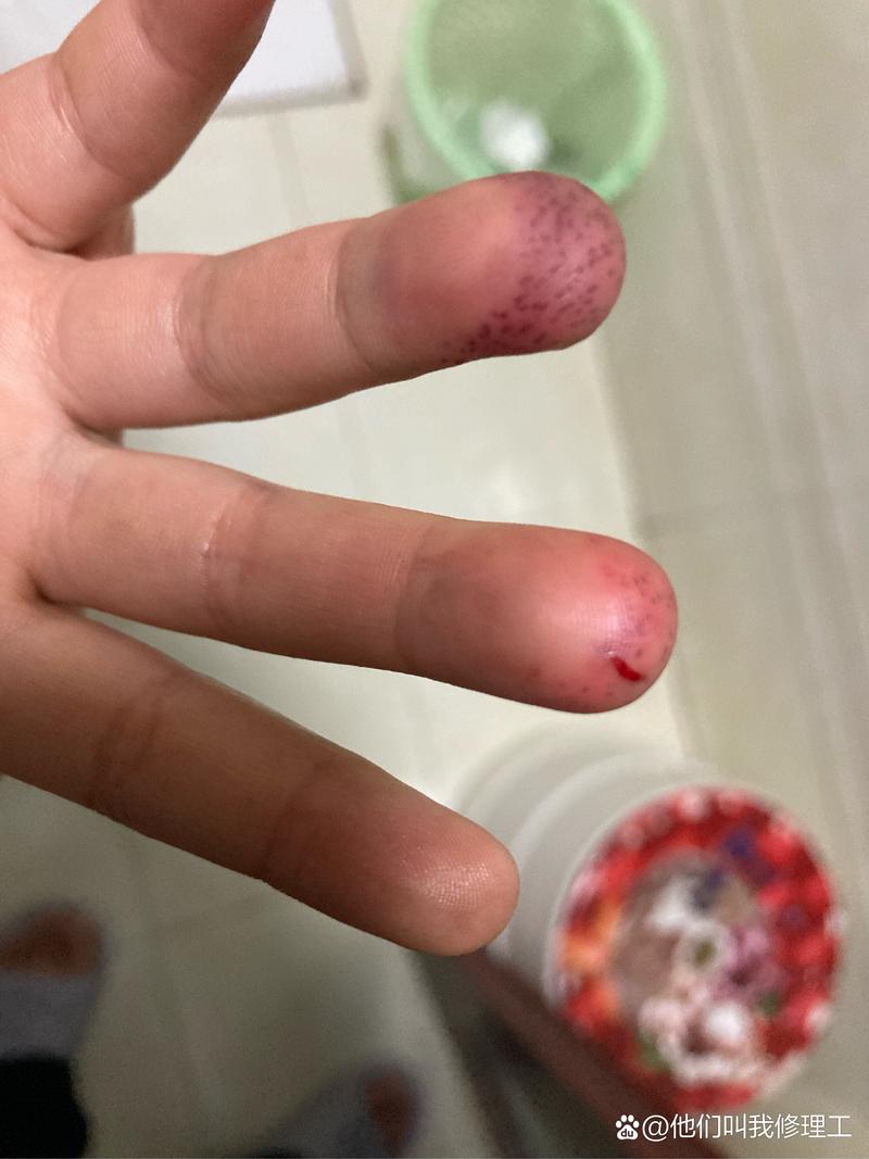 新澳门平特一肖100期开奖结果和被狗主人殴打致骨折与狗被打骨折了怎么办
